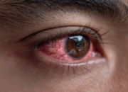 Arti Mimpi Keluar Darah menurut Agama, Psikologi dan Primbon Jawa