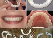 Arti Mimpi Lepas Gigi Atas menurut Agama, Psikologi dan Primbon Jawa