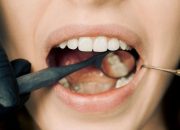 Arti Mimpi Gigi Goyang Bagian Atas menurut Agama, Psikologi dan Primbon Jawa