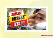 Arti Mimpi Disengat Lebah Di Wajah menurut Agama, Psikologi dan Primbon Jawa