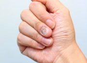 Arti Mimpi Kuku Lepas menurut Agama, Psikologi dan Primbon Jawa